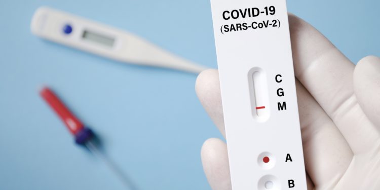 Havacılık toparlanma için hızlı testi bekliyor