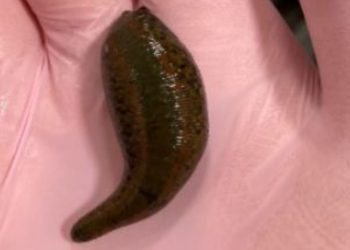 İstanbul Havalimanı’nda 4 bin canlı tıbbi sülük ele geçirildi